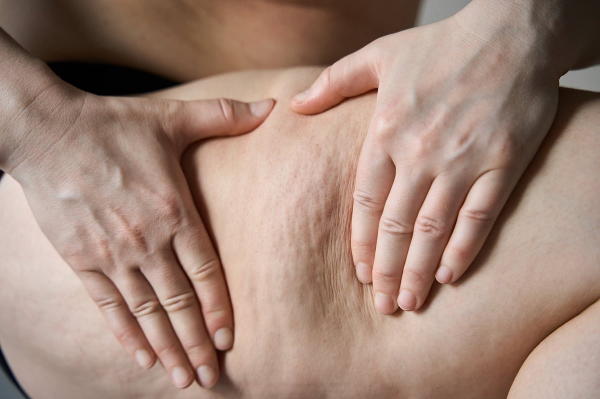 Masaje reafirmante: técnicas para tonificar y estimular la piel de muslos y caderas